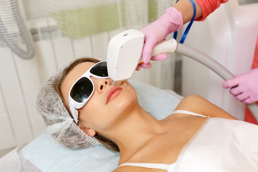 A treatment bed, wearing white protective eyewear and a disposable hair cap, receiving a laser hair removal or skin treatment on her upper lip area.