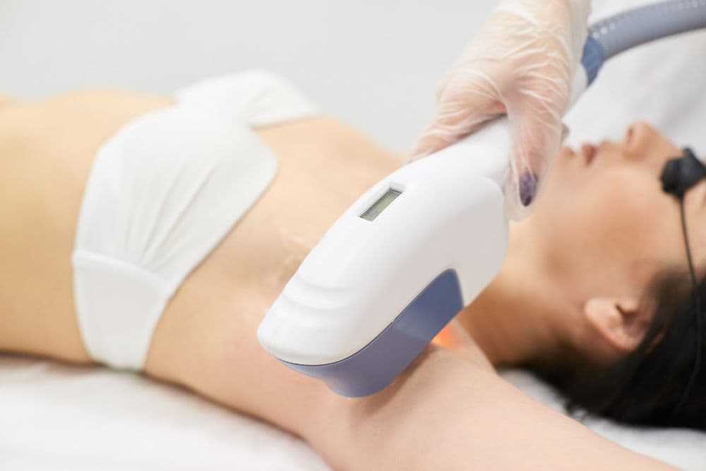 A client lying down, receiving an underarm laser hair removal or skin treatment.