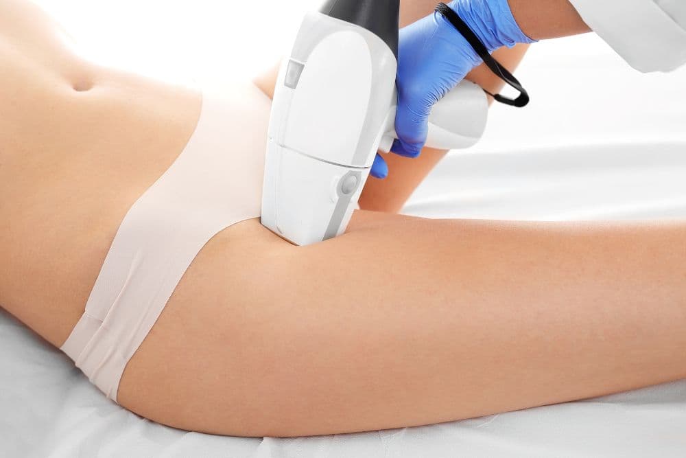 A person lying down, receiving a laser hair removal or skin treatment on the upper thigh or bikini area.
